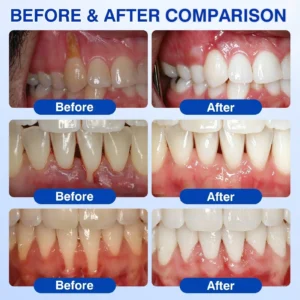GumRevive Periodontal Repair Gel - Image 3