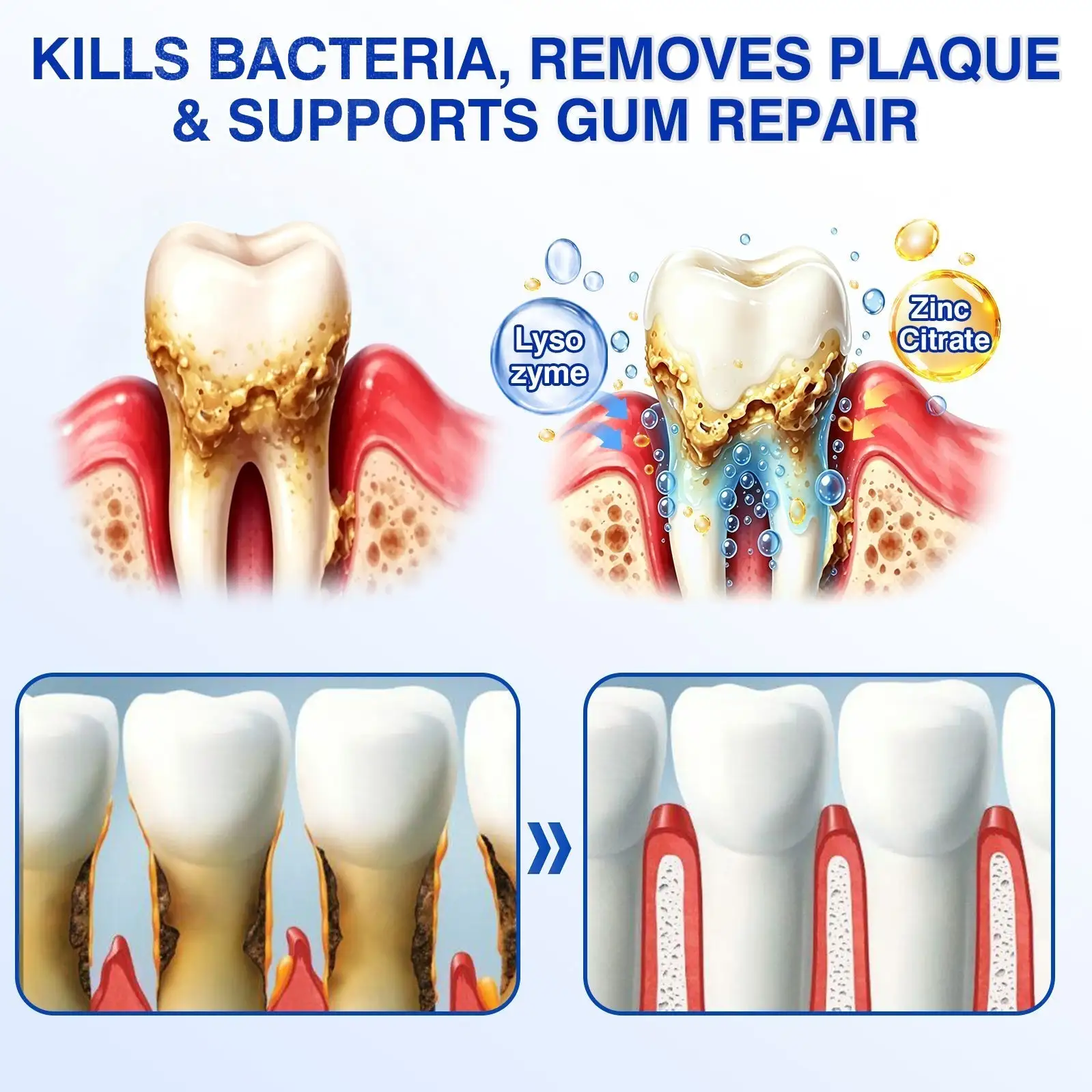 GumRevive Periodontal Repair Gel - Image 7