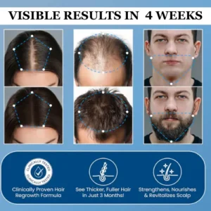 Hair Growth Roll on Serum - Image 6