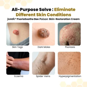 PsoriaSoothe Bee Poison Skin Restoration Cream - Image 2