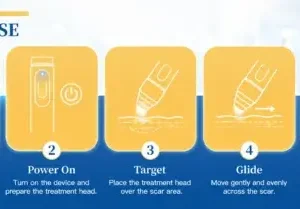 Laser Scar Care Pen - Image 5