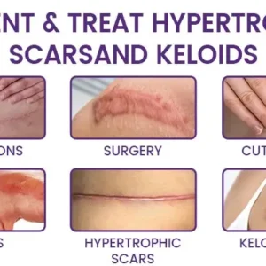 Grunsify Scar Repair Gel - Image 3