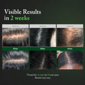 LOVILDS PDRN Scalp Serum - Image 6