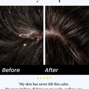 Natural Calming Serum - Image 4