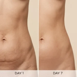 Skavix ANTI-AGING BODY OIL - Image 5