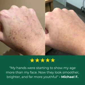 Lovilds Age Spot Cream - Image 8