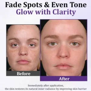 Lovilds Epiglow Melanev Advanced Anti Pigmentation Cream - Image 4