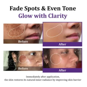 Lovilds Epiglow Melanev Advanced Anti Pigmentation Cream - Image 6