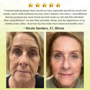 Botox & Multi-Peptide Retinol Shot Wrinkle-Lift Tightening Cream - Image 6