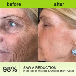 Botox & Vita-A Retinol Shot Wrinkle-Lift Tightening Cream - Image 11