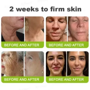 Botox & Vita-A Retinol Shot Wrinkle-Lift Tightening Cream - Image 7