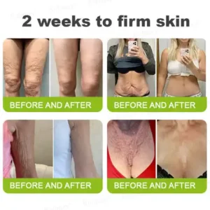 Botox & Vita-A Retinol Shot Wrinkle-Lift Tightening Cream - Image 8
