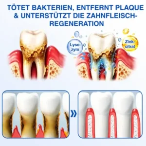 GumCare Pro | Zahnfleischpflege & Parodontal Gel - Image 6