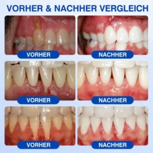 GumCare Pro | Zahnfleischpflege & Parodontal Gel - Image 8