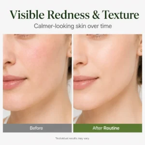 NESLEMY 10% Azelaic Acid + Hyaluron Soothing Serum - Image 4