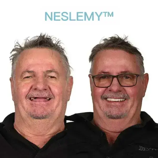 GelFit Dentures