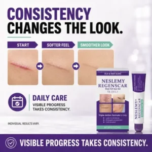 Scar Gel - Image 4