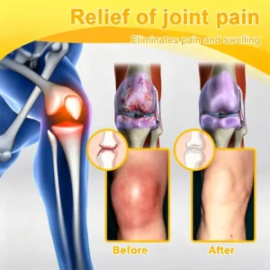 Joint Pain Relief Patches - Image 11