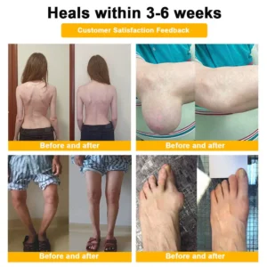 Joint Pain Relief Patches - Image 4
