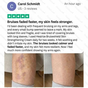 BRUISESHIELD Skin Strengthening Cream - Image 3