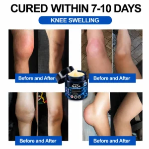 NAD+ Advanced Anti-Aging Joint Relief Cream - Image 4