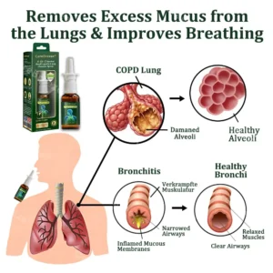 6-in-1 Herbal BeePropolis Lung Cleanse Spray - Image 3