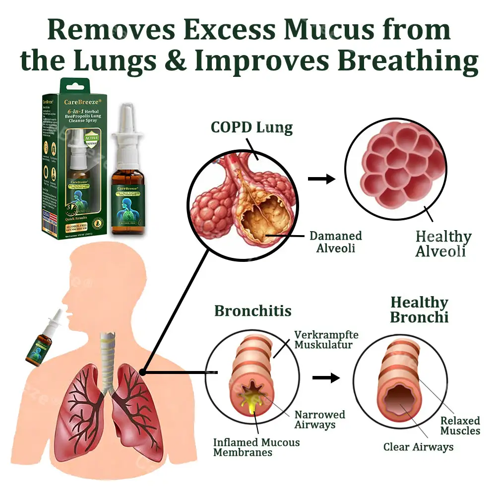6-in-1 Herbal BeePropolis Lung Cleanse Spray - Image 3