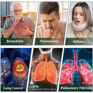 6-in-1 Herbal BeePropolis Lung Cleanse Spray - Image 5