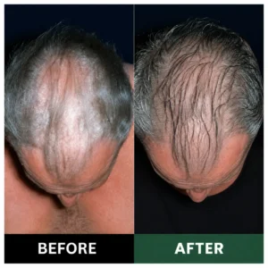 Avocado & Orange Nourishing Anti-Dandruff Scalp Scrub - Image 3