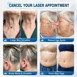 Alternative view of Targeted Skin Tag & Spot Care Cream