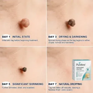 6-in-1 Hydrocolloid Patch - Image 9