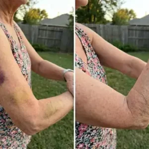 Bruise & Visible Marks Cream - Image 7