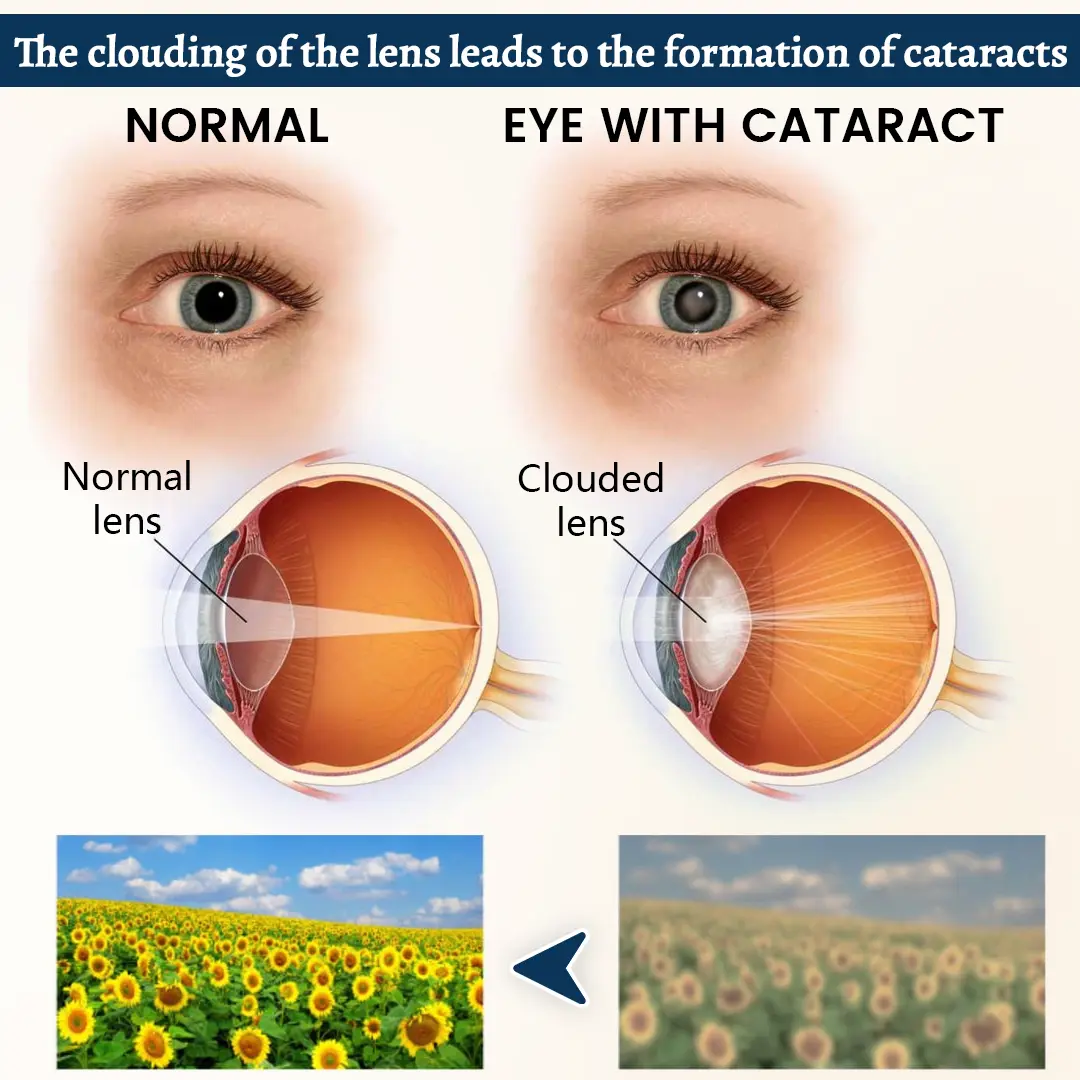 Potent Vision Support Eye Patch - Image 4