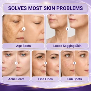 Age Renewal Dark Spot Serum - Image 3