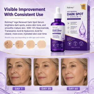 Age Renewal Dark Spot Serum - Image 4