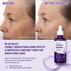 Age Renewal Dark Spot Serum - Image 5