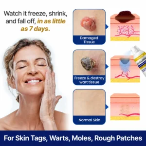 Bump Renewal Spray - Image 6