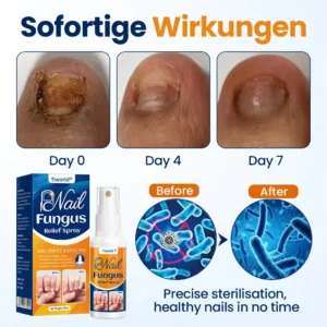Nail fungus relief spray - Image 3