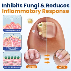 Nail fungus relief spray - Image 4