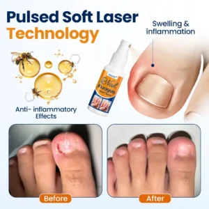 Nail fungus relief spray - Image 5
