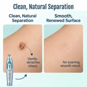 SpotlessPro Advanced Skin Care Pen - Image 8