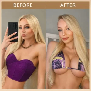 Targeted Breast Enhancement Advanced Nano Microneedle Patch - Image 4