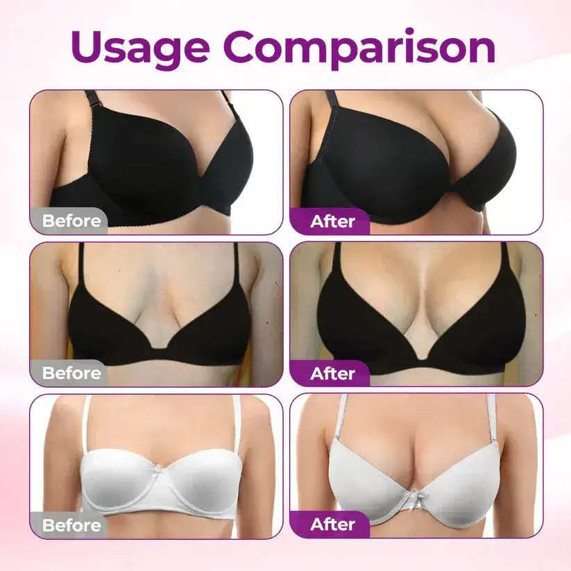 Targeted Breast Enhancement Advanced Nano Microneedle Patch - Image 7