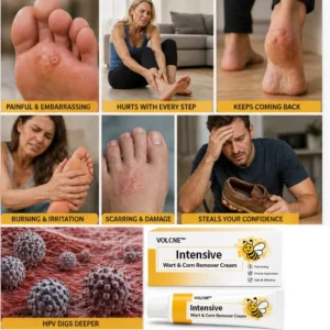 Intensive Wart & Corn Remover Cream - Image 6
