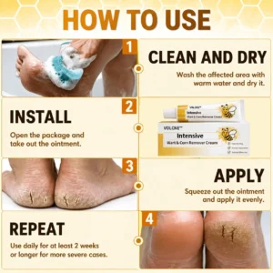 Intensive Wart & Corn Remover Cream - Image 2