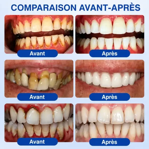 ๐ฎ๐๐๐น๐๐๐๐๐ ๐ฎ๐๐ ๐
๐ ๐นรฉ๐๐๐๐๐๐๐๐ ๐ท๐๐๐๐
๐๐๐๐๐๐ - Image 13