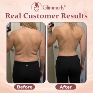 𝐁𝐫𝐞𝐚𝐬𝐭 𝐕𝐨𝐥𝐮𝐦𝐞 𝐁𝐨𝐨𝐬𝐭 & 𝐅𝐢𝐫𝐦 𝐌𝐢𝐜𝐫𝐨-𝐍𝐞𝐞𝐝𝐥𝐞 𝐏𝐚𝐭𝐜𝐡𝐞𝐬 - Image 8