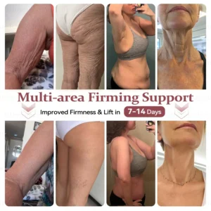 𝐁𝐫𝐞𝐚𝐬𝐭 𝐕𝐨𝐥𝐮𝐦𝐞 𝐁𝐨𝐨𝐬𝐭 & 𝐅𝐢𝐫𝐦 𝐌𝐢𝐜𝐫𝐨-𝐍𝐞𝐞𝐝𝐥𝐞 𝐏𝐚𝐭𝐜𝐡𝐞𝐬 - Image 9