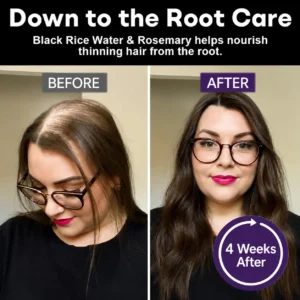 Black Rice & Red Onion Hair Growth Spray - Image 2