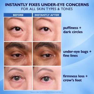 Eye Tightener Easy - Image 2